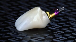 Makroaufnahme von Implantat samt Krone auf einem strukturierten Hintergrund