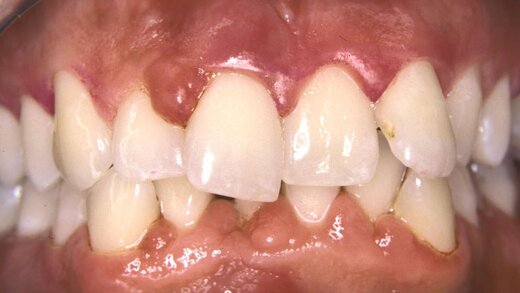 579209-flexible-1900 579209-flexible-1900