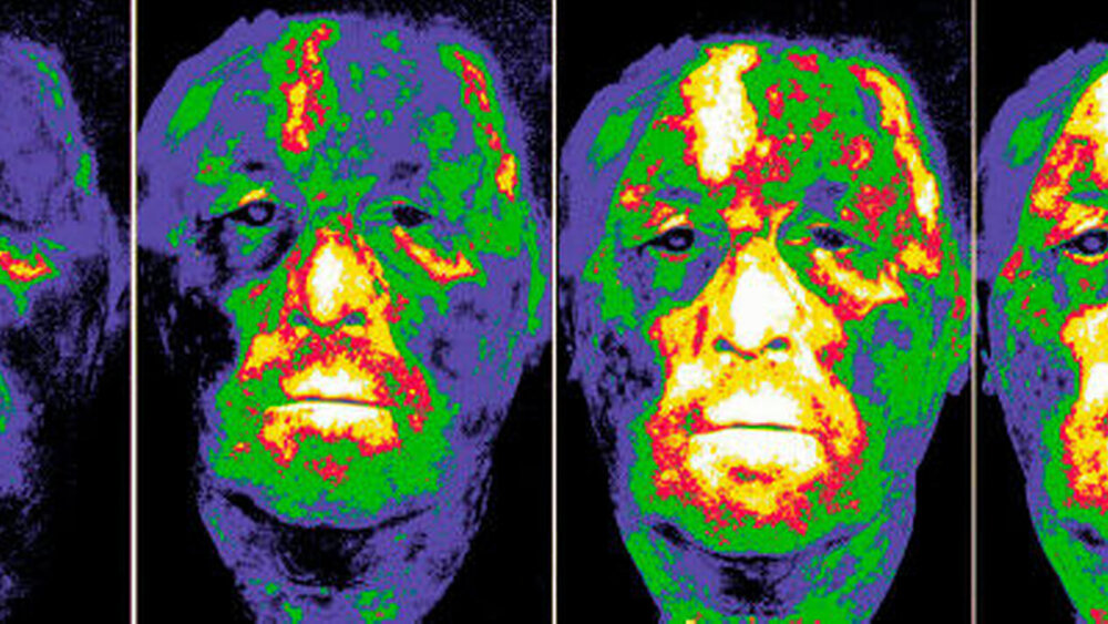 Die Ausbreitung der Schmerzen |