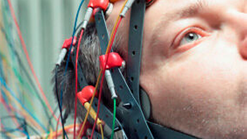 Mindestens 50 Prozent der Epilepsien sind genetisch bedingt. | Mindestens 50 Prozent der Epilepsien sind genetisch bedingt. |