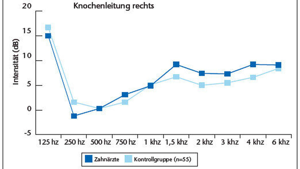 Grafik 2a: Ergebnisse des audiometrischen Tests für die Knochenleitung zum rechten Ohr |