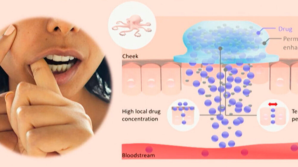 W.A. de Vigier Foundation Ocotopatch