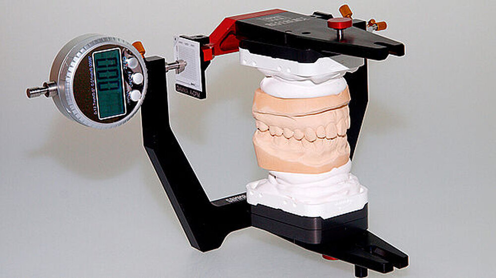 Abbildung 1 und 2: Beispiel für ein stationäres Kondylenpositions-Messinstrument (hier: A-CPM, Fa. Gamma Dental, A-3400 Klosterneuburg); links: Positionierung der Ober- und Unterkiefermodelle in maximaler Interkuspidation; rechts: Positionierung der Obe Abbildung 1und 2: Beispiel für ein stationäres Kondylenpositions-Messinstrument (hier: A-CPM, Fa. Gamma Dental, A-3400 Klosterneuburg); links: Positionierung der Ober- und Unterkiefermodelle in maximaler Interkuspidation; rechts: Positionierung der Ober- und Unterkiefermodelle in zentrischer Kieferrelation mittels eines Registrates in zentrischer Kondylenposition.