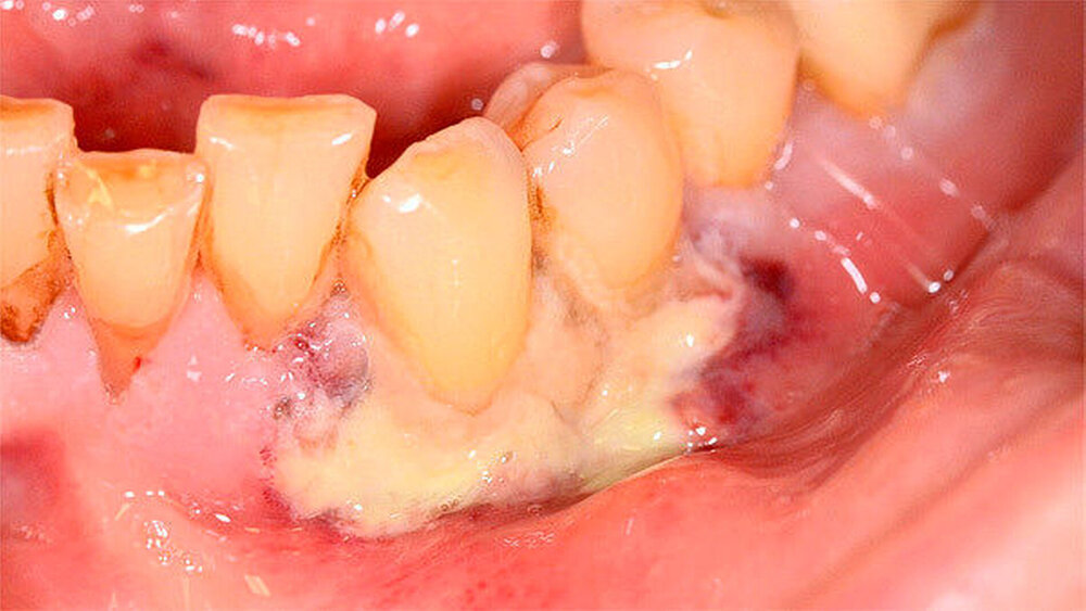 Abbildung 1: Klinischer Ausgangsbefund |