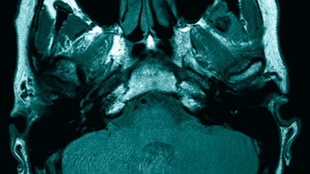 b) ohne Kontrastmittel |