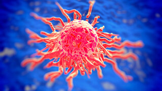 Cervical cancer cell