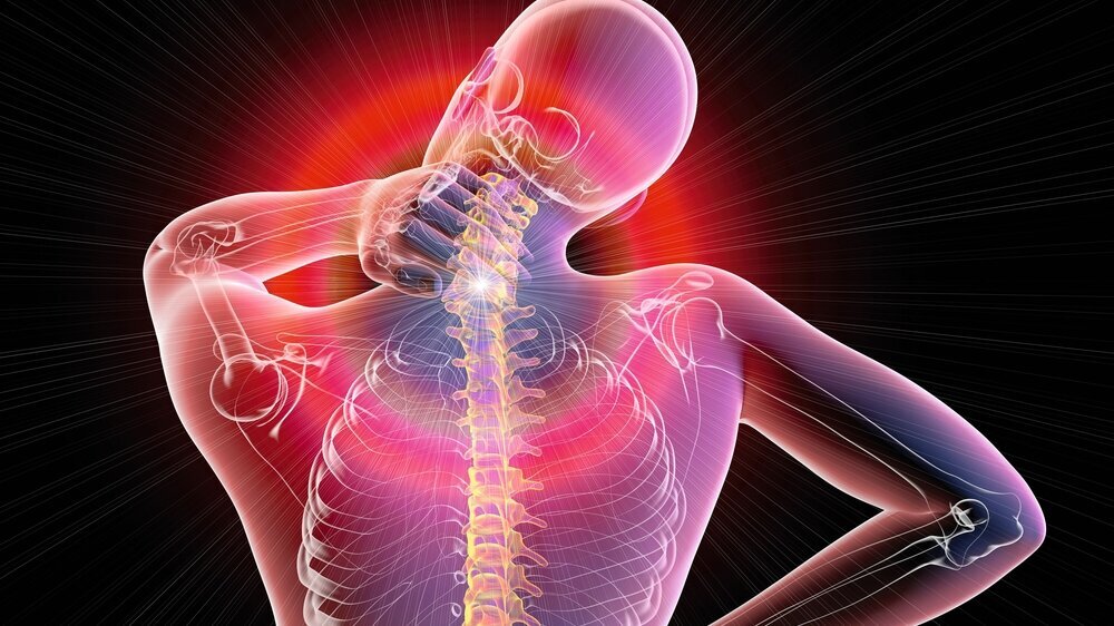 Neck pain, illustration Nackenschmerzen, Fibromyalgie