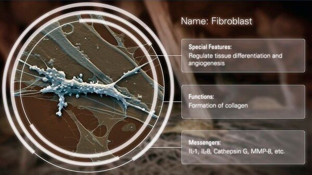 Abbildung 3: Steckbrief Fibroblast: REM-Aufnahme eines Fibroblasten, 1 800- fache Vergrößerung |
