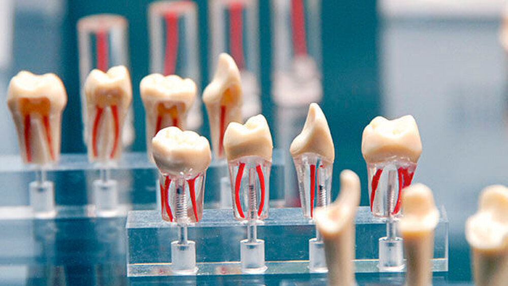 Das Corpus Delicti in Rot: 3-D-Darstellung von Wurzelkanälen auf der Internationalen Dental-Schau\r\n