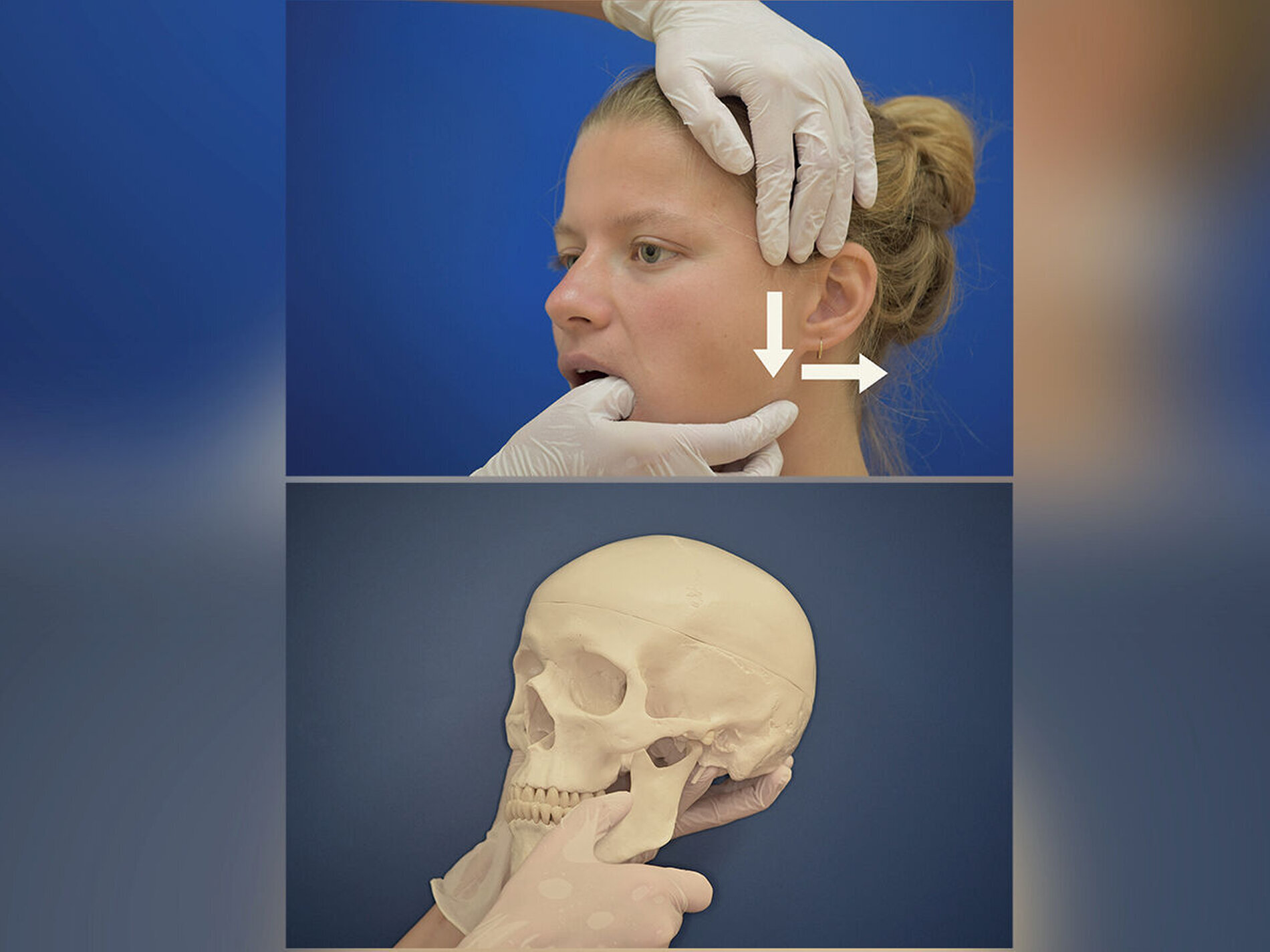 Diagnostik und Therapie der Kiefergelenkluxation