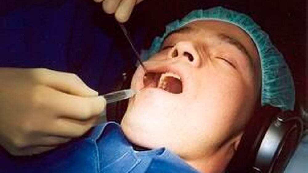 Abb. 1: Oralchirurgische Patientenbehandlung in kombinierter Lokalanästhesie und Hypnose (hier: über Kopfhörer eingespielte zahnärztliche Hypnose-CD).
