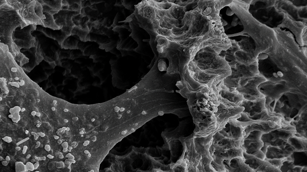 Knochenzellen auf der Implantatoberfläche\r\n\r\n