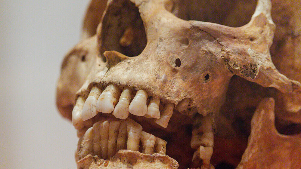 Close-up view of an ancient human skull showing teeth and eye sockets.
