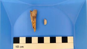 Erreger in 4.000 Jahre altem Schafszahn entdeckt
