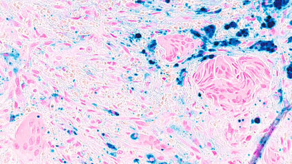 Abbildung 6: Nachweis der Blutungen mittels Berliner Blau-Reaktion (Vergrößerung x30). |