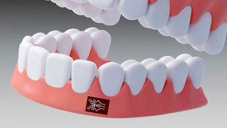 Biosensor erkennt Entzündungsmarker im Mund mit molekularer Präzision.