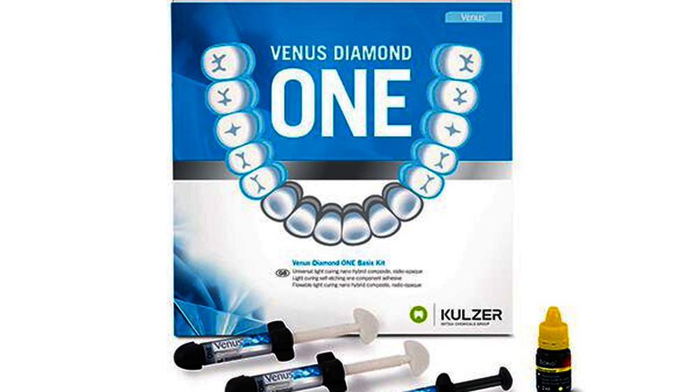Venus Diamond ONE lässt sich bequem modellieren, lange verarbeiten und ist äußerst standfest. Das erleichtert etwa einfache Seitenzahnrestaurationen im Mehrschichtverfahren.