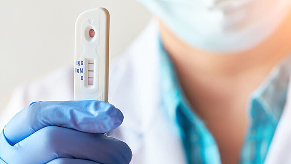 Obwohl in der Wissenschaft Einigkeit darüber besteht, dass Antikörpertests mit einigen Ungenauigkeiten einhergehen, bieten Ärzte sie den Versicherten laut MDS an – auch als Individuelle Gesundheitsleistung (IGeL).