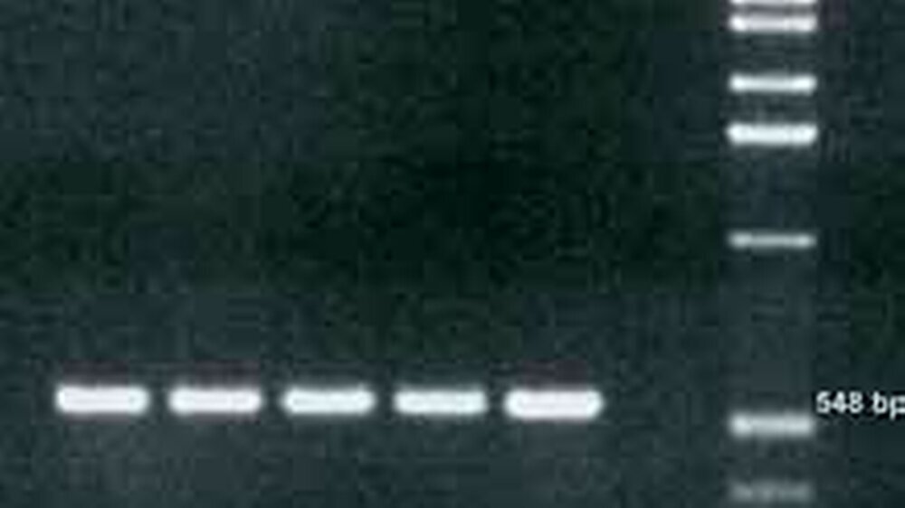 Polymerasekettenreaktion (PCR)