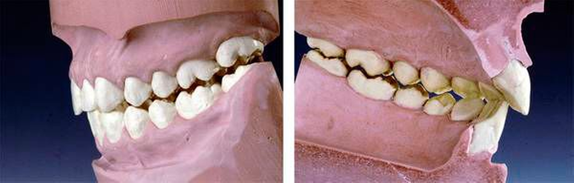 155691-flexible-1900.jpg 155691-flexible-1900.jpg