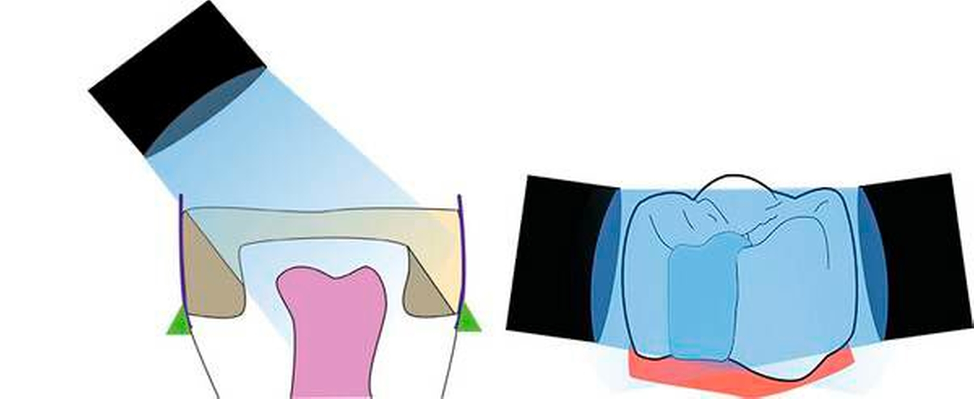 155750-flexible-1900.jpg 155750-flexible-1900.jpg