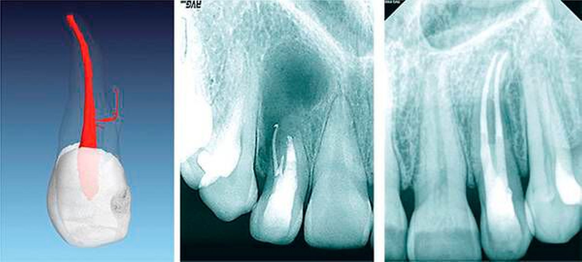 155856-flexible-1900.jpg 155856-flexible-1900.jpg