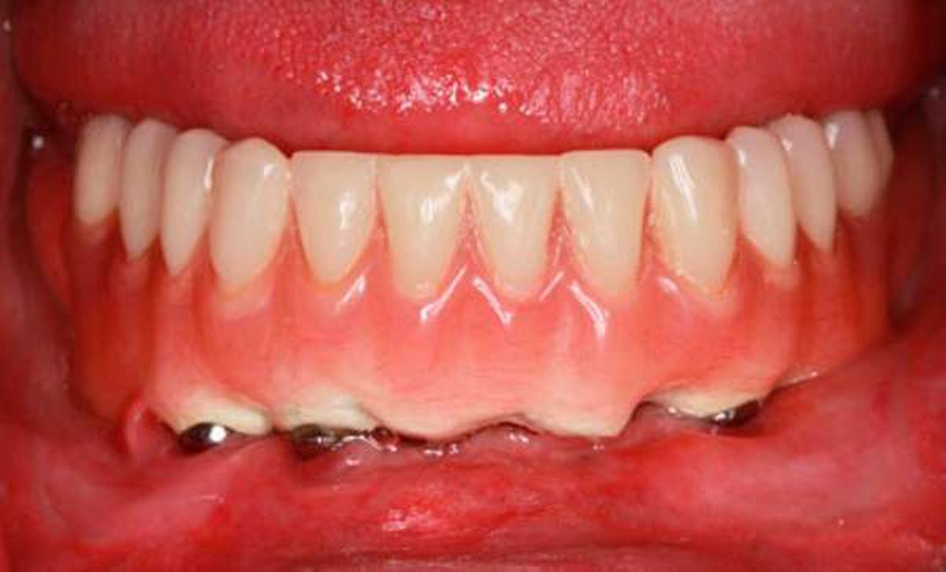 154614-flexible-1900.jpg 154614-flexible-1900.jpg