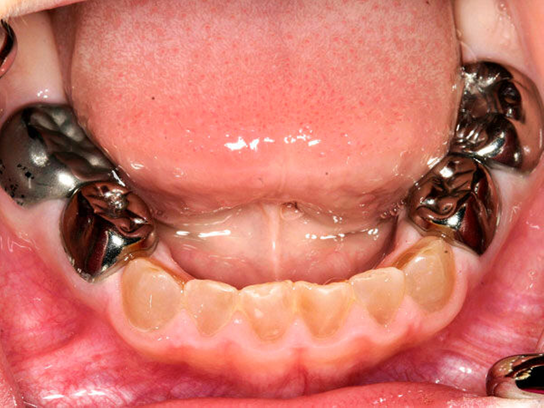 154693-flexible-1900.jpg 154693-flexible-1900.jpg