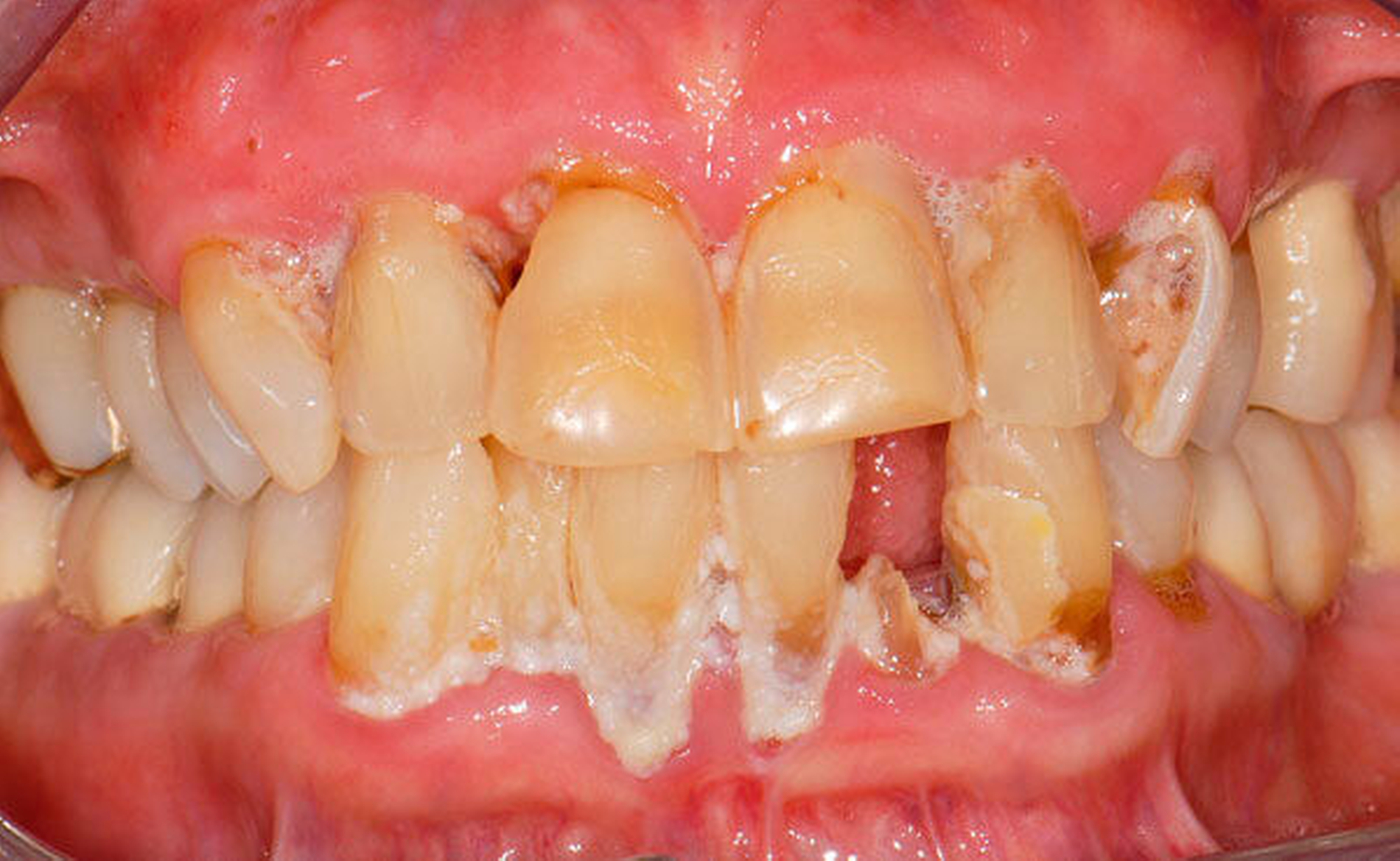 264816-flexible-1900.jpg 264816-flexible-1900.jpg