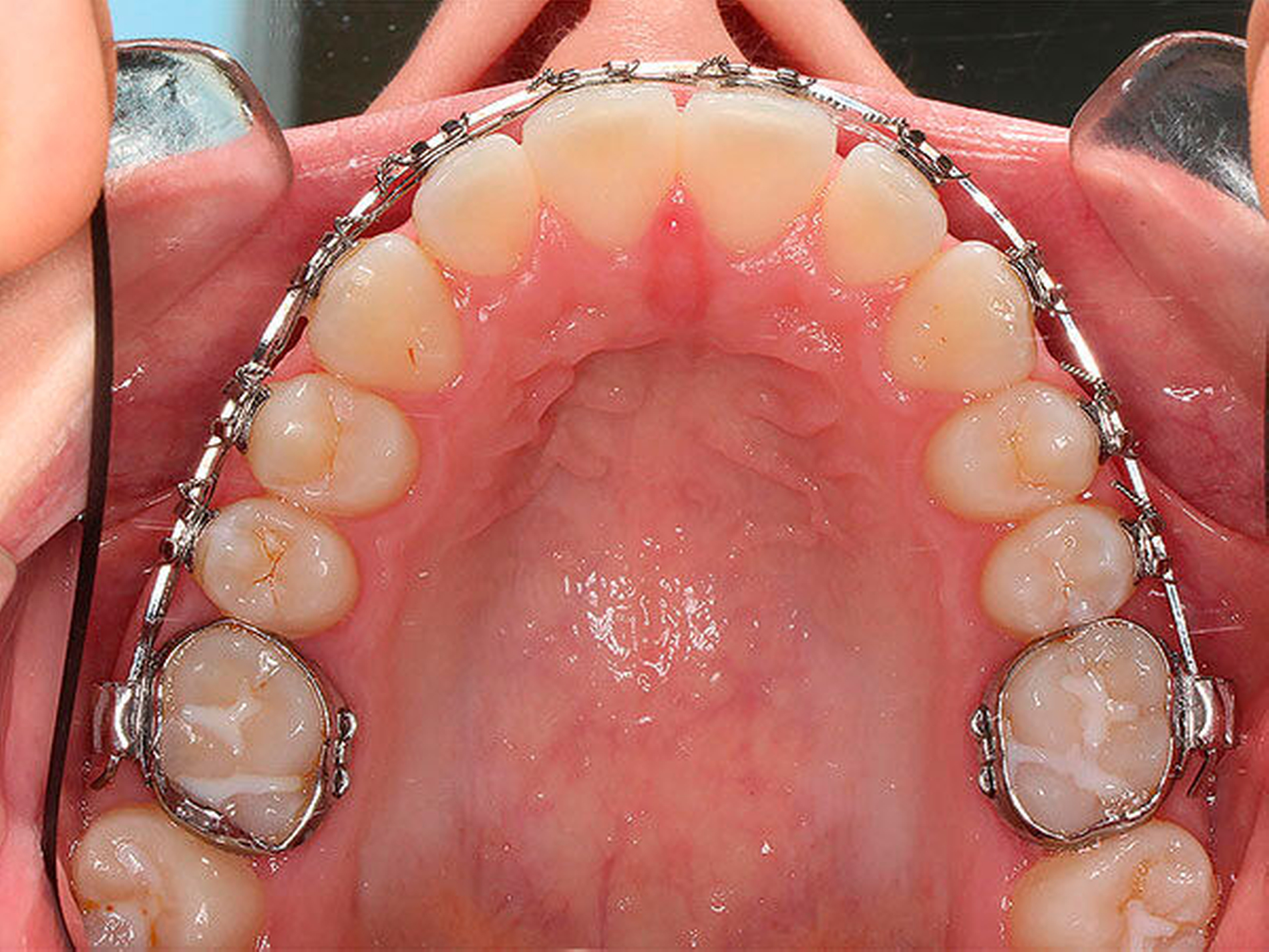 262750-flexible-1900.jpg 262750-flexible-1900.jpg