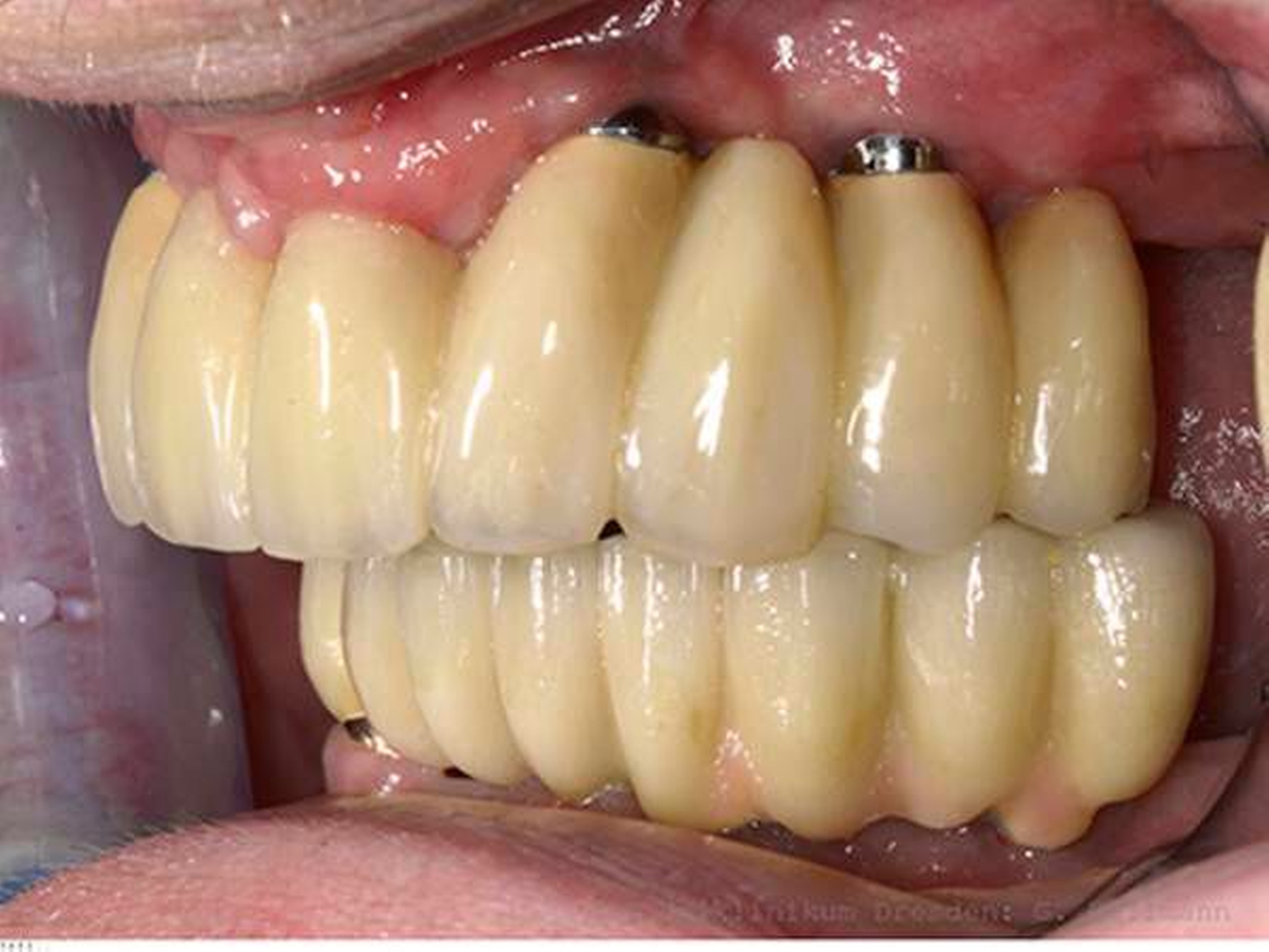 158288-flexible-1900.jpg 158288-flexible-1900.jpg