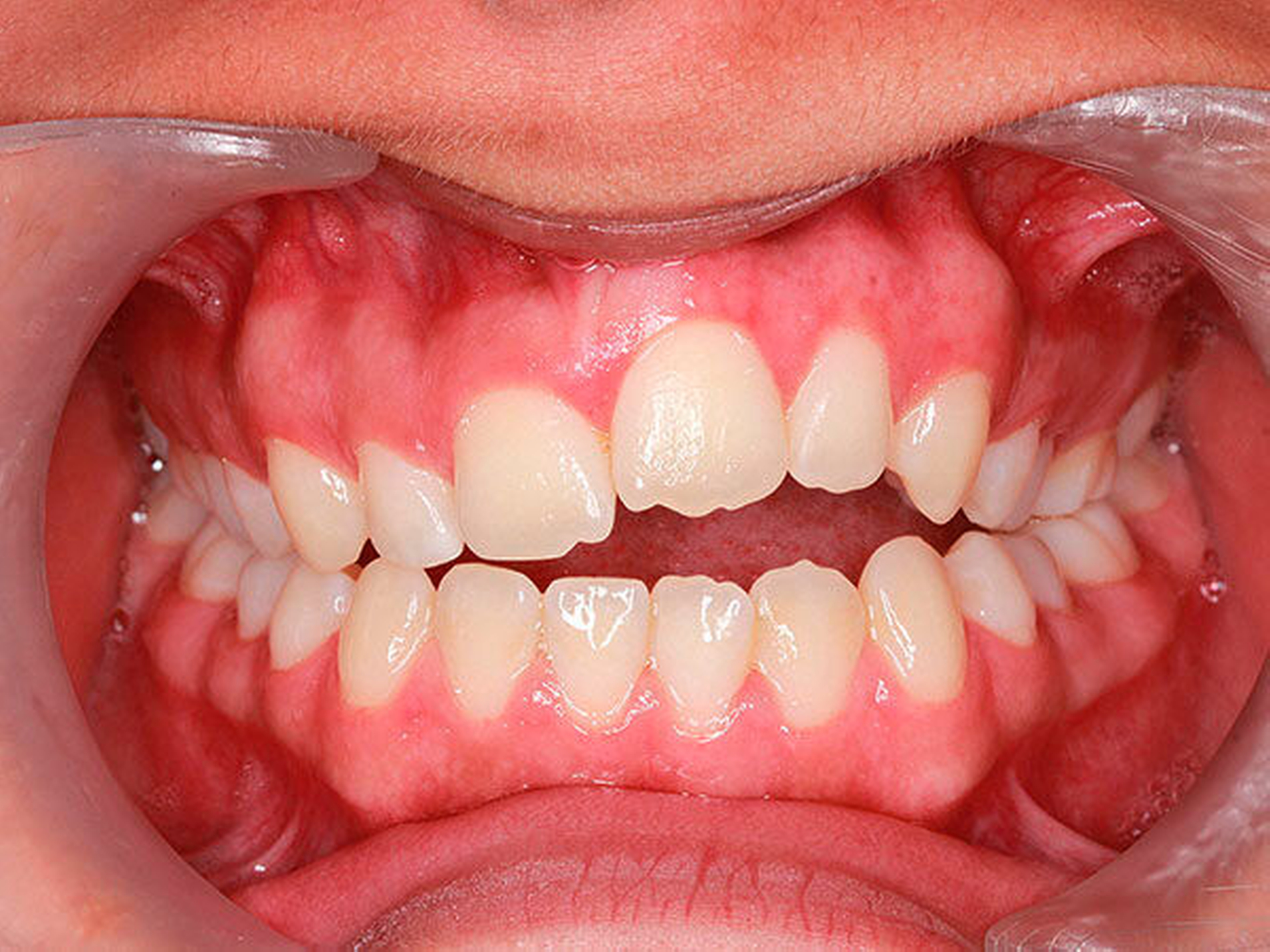 158396-flexible-1900.jpg 158396-flexible-1900.jpg