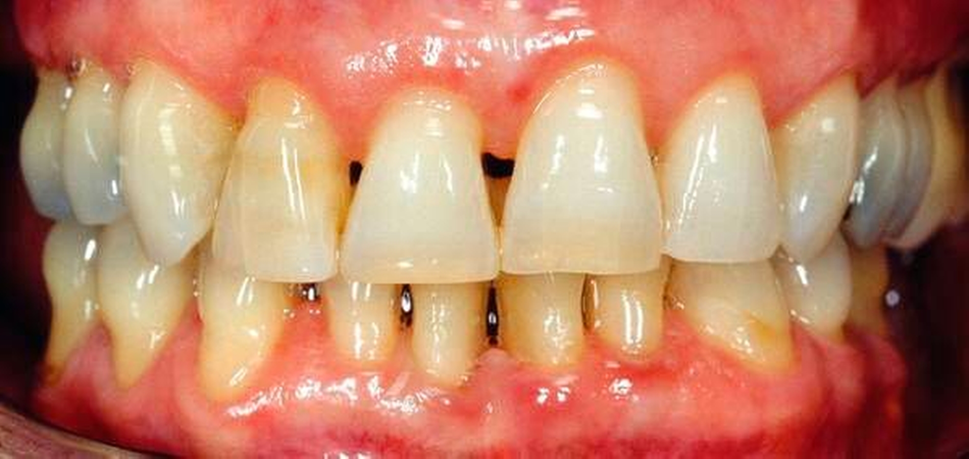 262518-flexible-1900.jpg 262518-flexible-1900.jpg