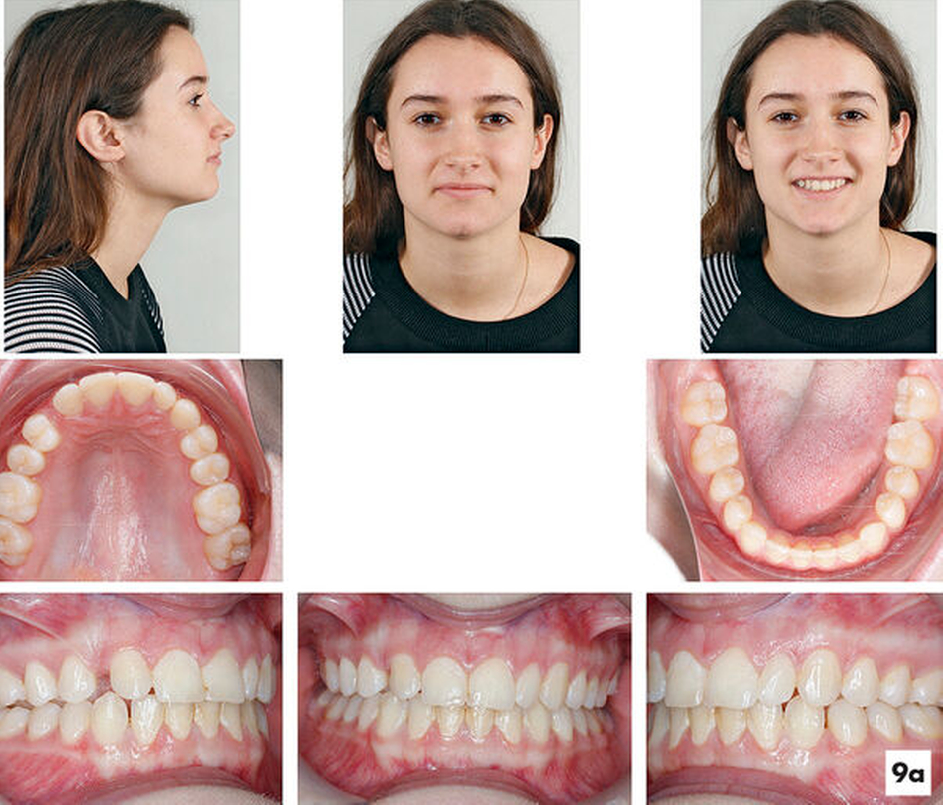 158932-flexible-1900.jpg 158932-flexible-1900.jpg