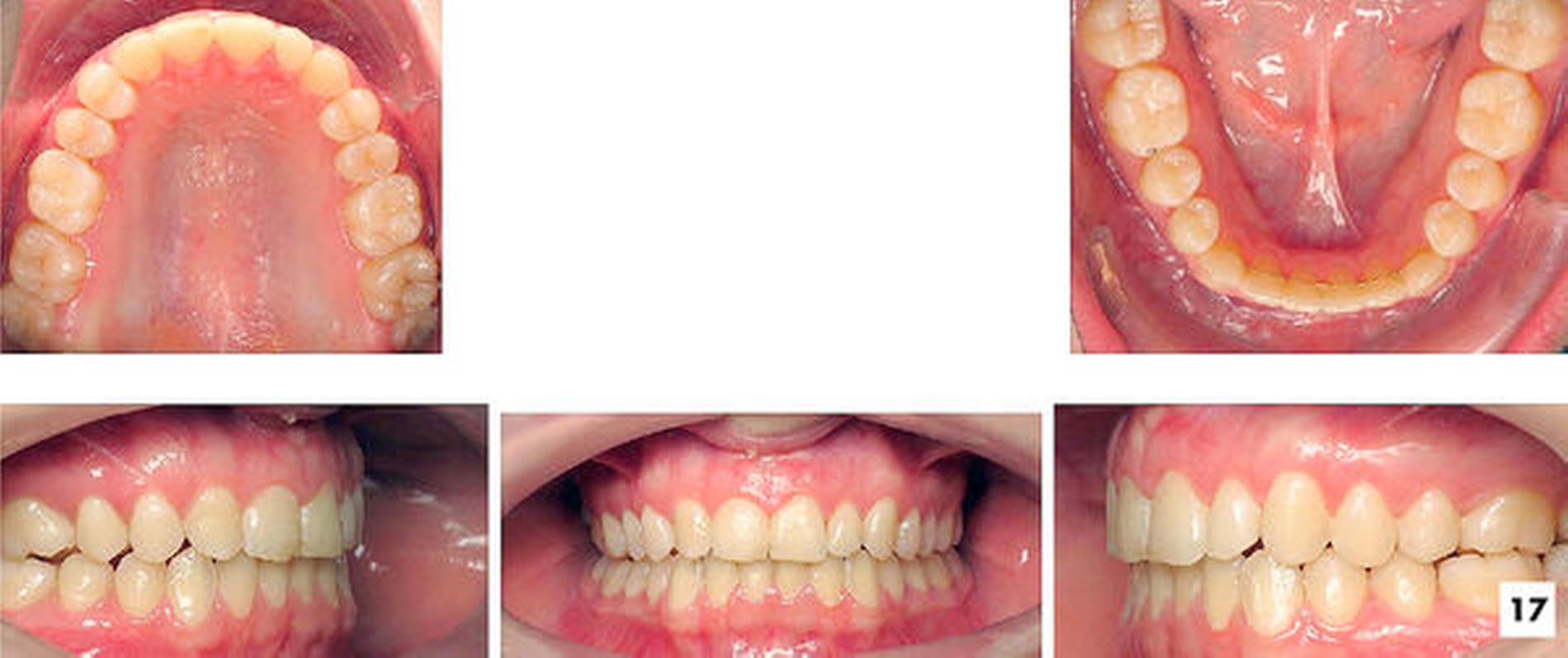 158942-flexible-1900.jpg 158942-flexible-1900.jpg