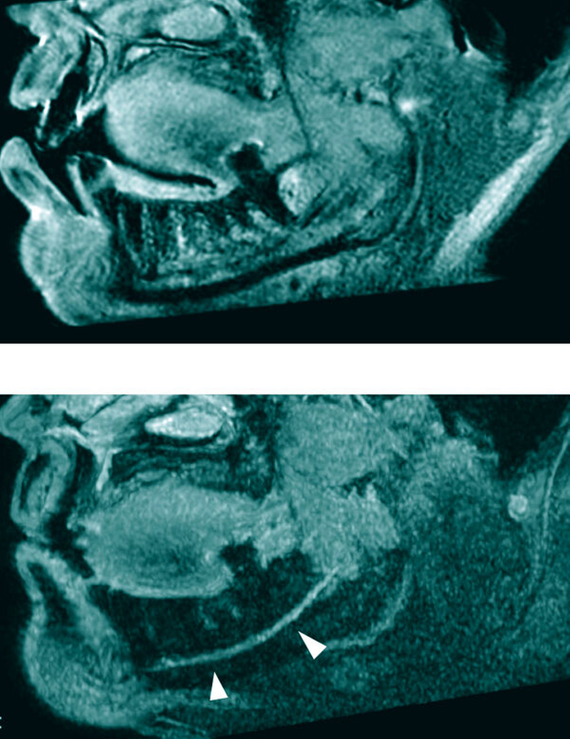 168241-flexible-1900.jpg 168241-flexible-1900.jpg