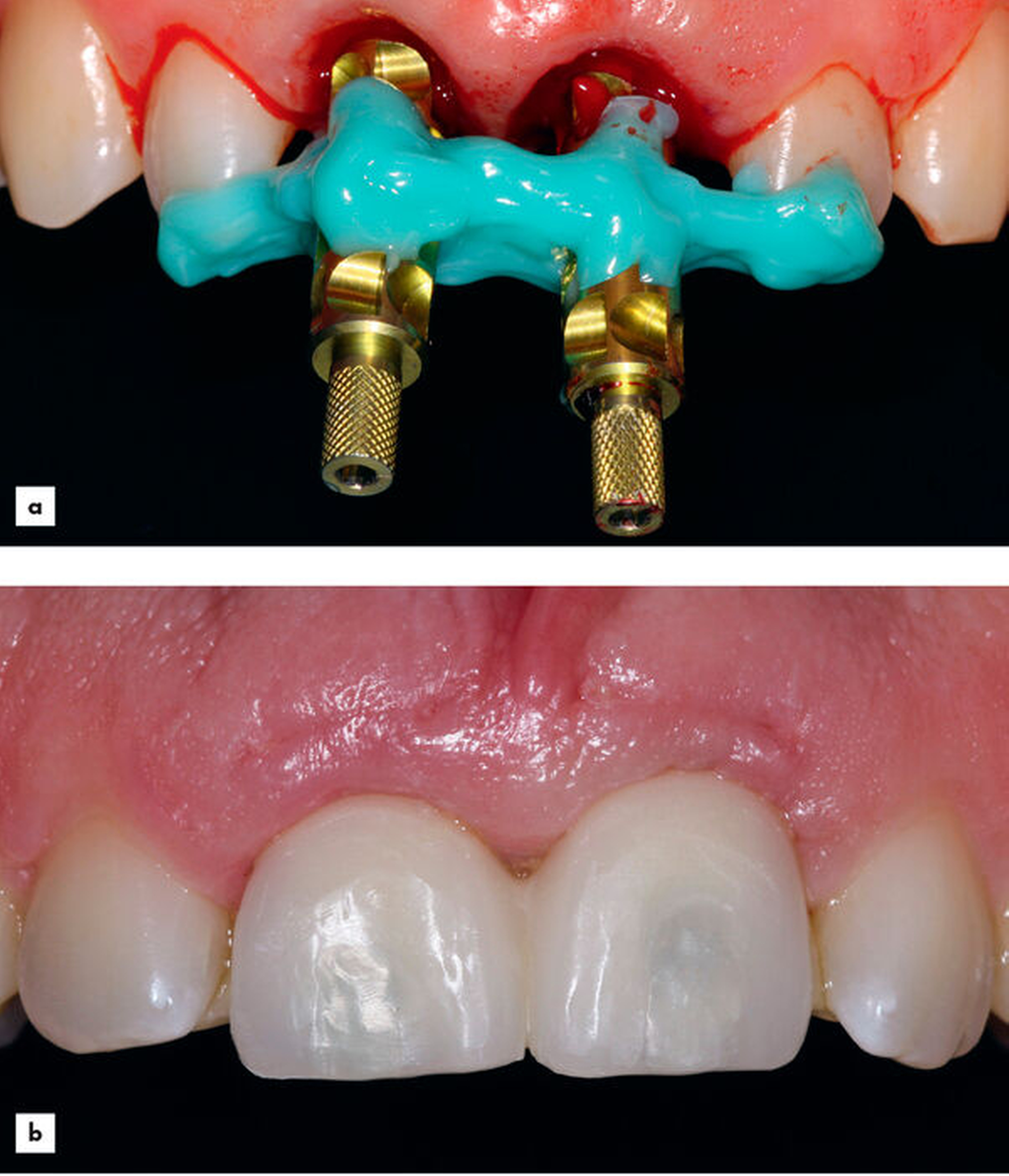 159753-flexible-1900.jpg 159753-flexible-1900.jpg