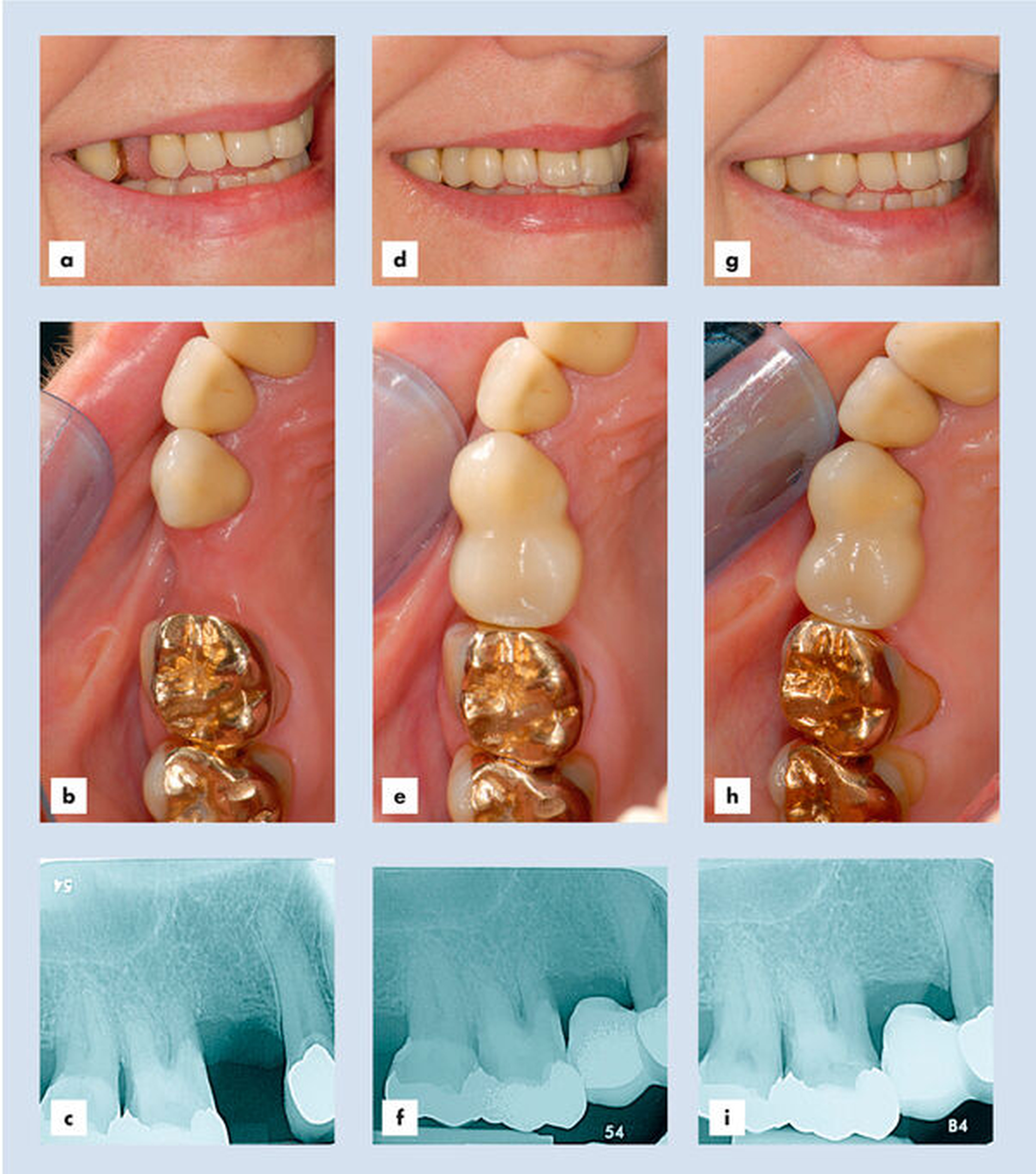 152821-flexible-1900.jpg 152821-flexible-1900.jpg