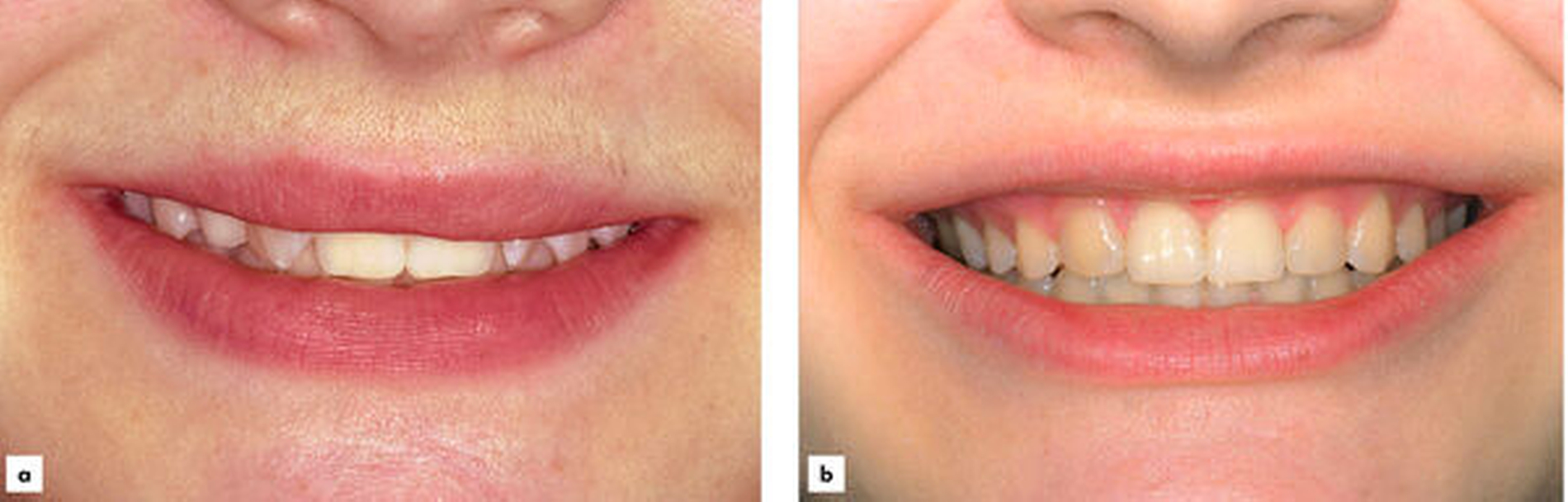 151842-flexible-1900.jpg 151842-flexible-1900.jpg