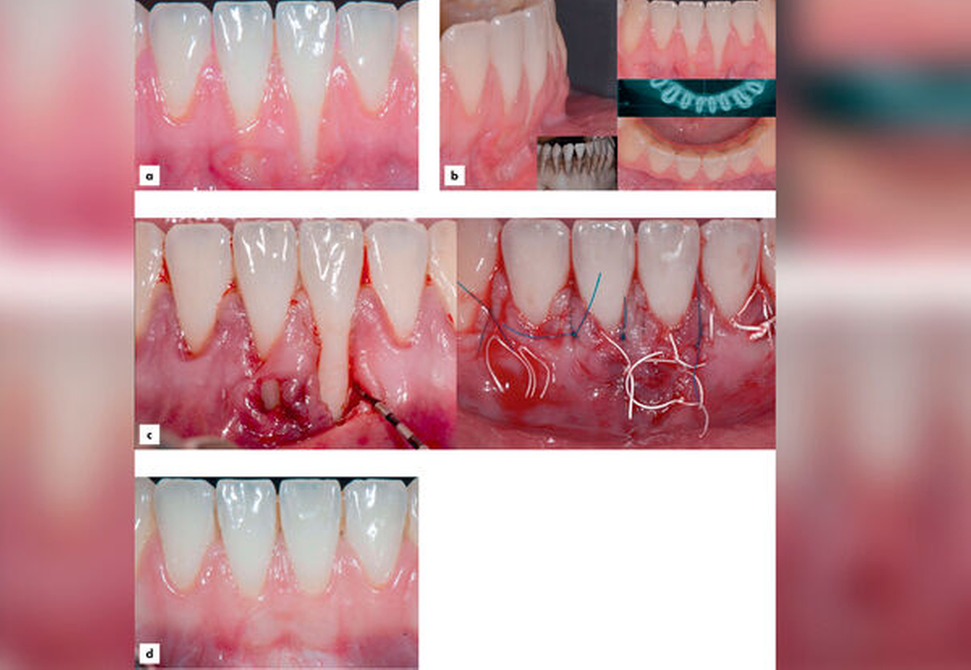 151725-flexible-1900.jpg 151725-flexible-1900.jpg