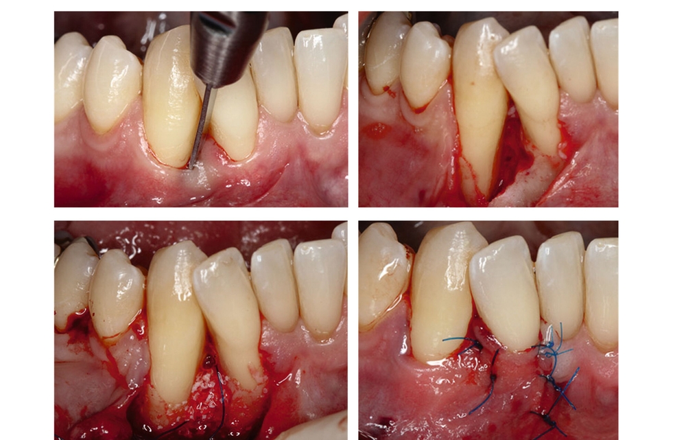 36858-flexible-1900.jpg 36858-flexible-1900.jpg