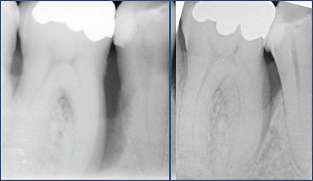 36863-flexible-1900.jpg 36863-flexible-1900.jpg