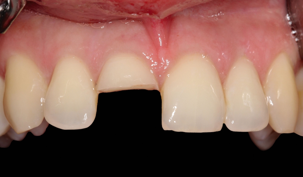 171553-flexible-1900.jpg 171553-flexible-1900.jpg