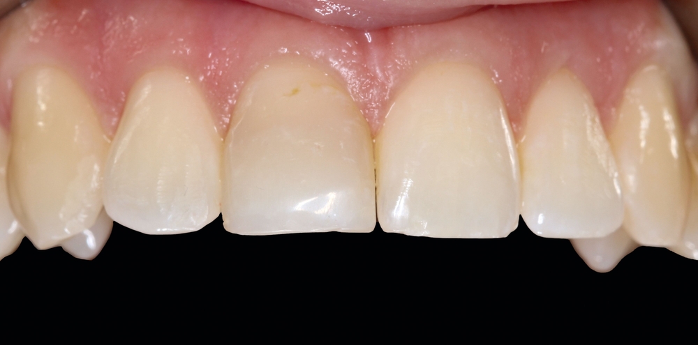 171562-flexible-1900.jpg 171562-flexible-1900.jpg