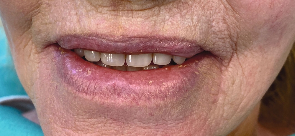 176397-flexible-1900.jpg 176397-flexible-1900.jpg