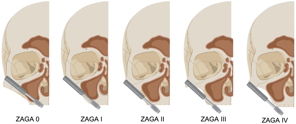 176400-flexible-1900.jpg 176400-flexible-1900.jpg