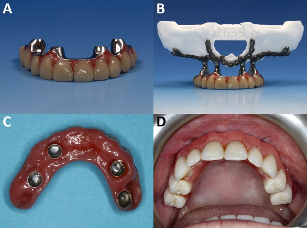 37032-flexible-1900.jpg 37032-flexible-1900.jpg