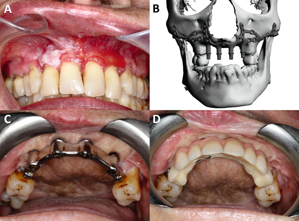 37041-flexible-1900.jpg 37041-flexible-1900.jpg