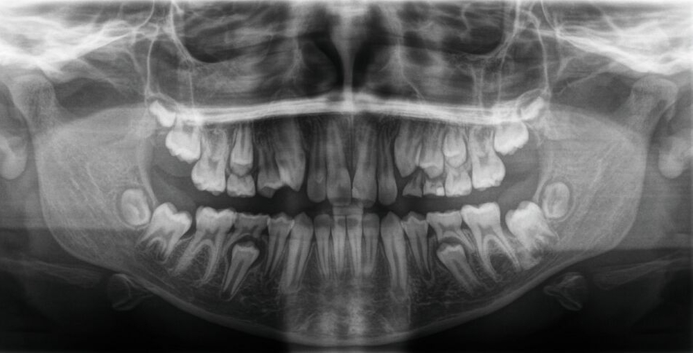 177920-flexible-1900.jpg 177920-flexible-1900.jpg