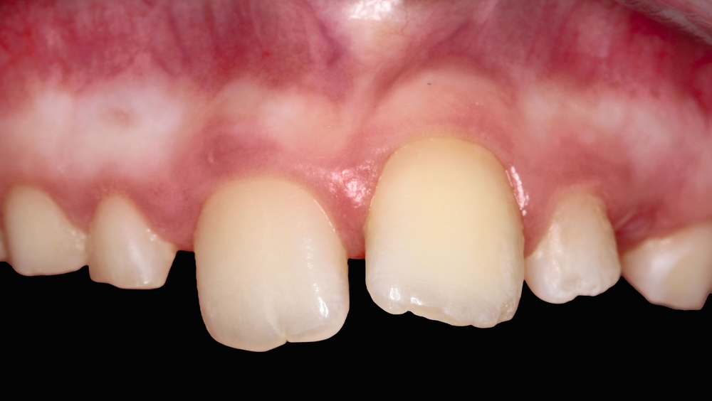 179938-flexible-1900.jpg 179938-flexible-1900.jpg